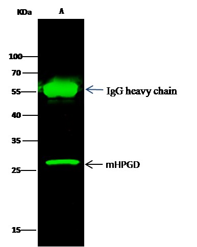 Recombinant HPGD/15-PGDH Monoclonal Antibody - small - 2