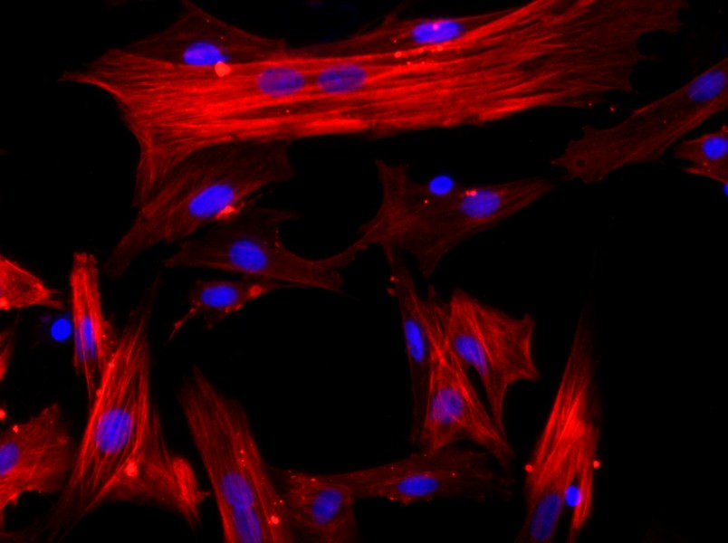 Rat Hepatic Stellate Cell Complete MediumRat Hepatic Stellate Cell Complete Medium - 2