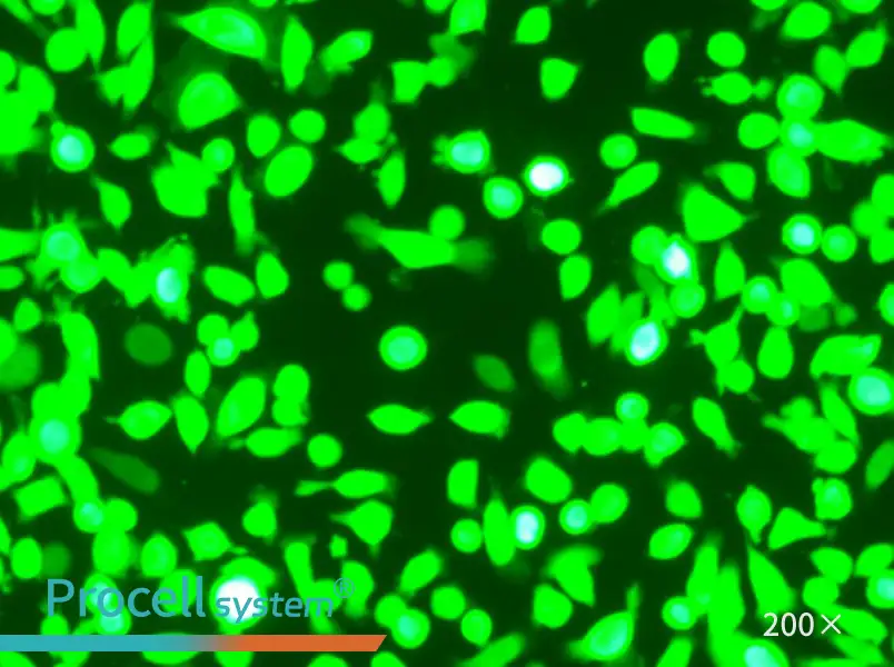 AGS-GFP Cell Complete Medium - 5