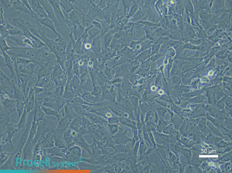 Rat Pulmonary Vascular Smooth Muscle Cell Complete Medium - 6