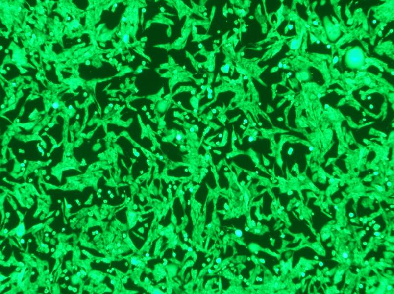 NCI-H446-GFP Cell Complete Medium - 2