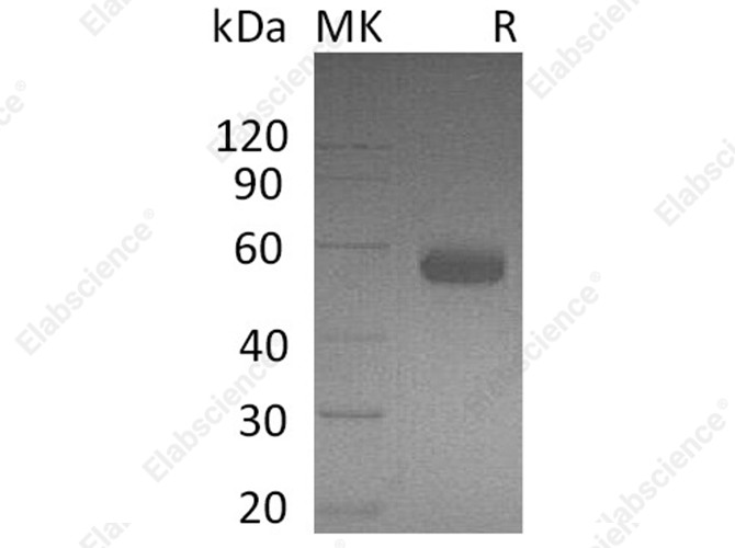 Recombinant Human BTLA/CD272 Protein (Fc Tag) - 1