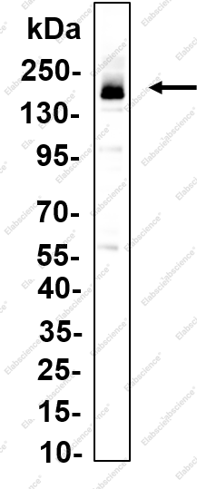 Recombinant FANCD2 Monoclonal Antibody - 1