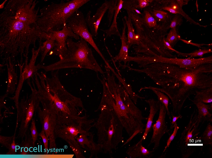 Mouse Synovial Cell Complete Medium - 1