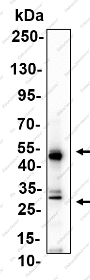 Recombinant MBD2 Monoclonal Antibody - 4