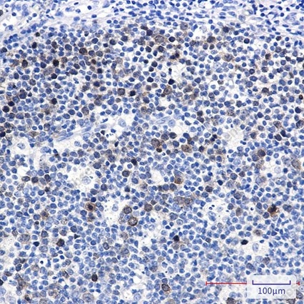 Recombinant UBE2C Monoclonal Antibody - 5