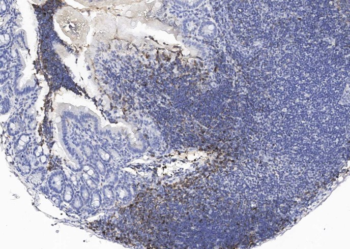 Recombinant CD19 Monoclonal Antibody-searchlist-1