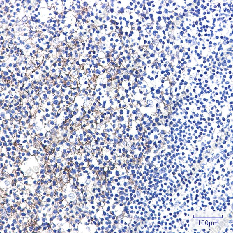Recombinant Semaphorin 7A Monoclonal Antibody - 2