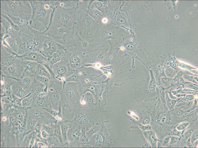 NCI-H2347 Cell Complete Medium - small - 5