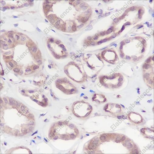 Recombinant Calpain small subunit 1 Monoclonal Antibody - 1