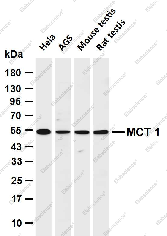 Recombinant SLC16A1 Monoclonal Antibody - 1