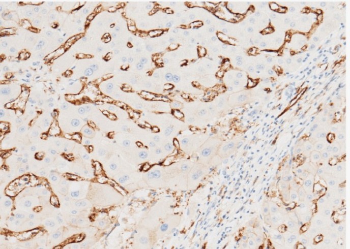 CD36/SCARB3 Monoclonal Antibody - small - 2