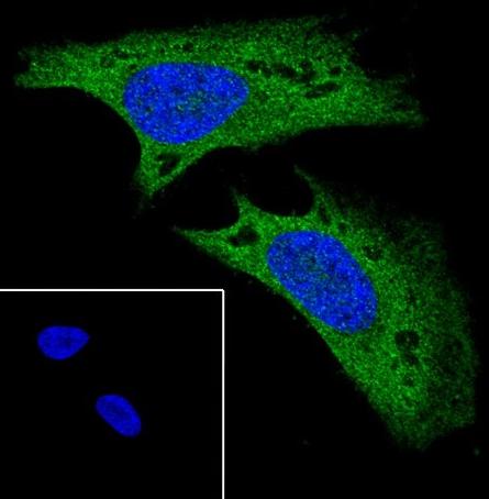 Recombinant ROCK2+ROCK1 Monoclonal Antibody - small - 5