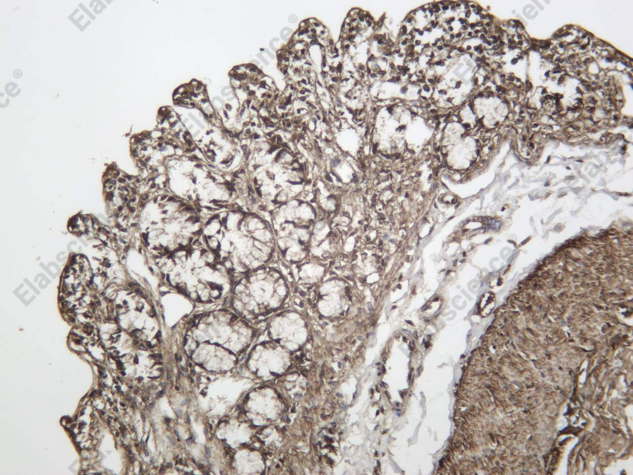 Recombinant HP1γ Monoclonal Antibody - 3