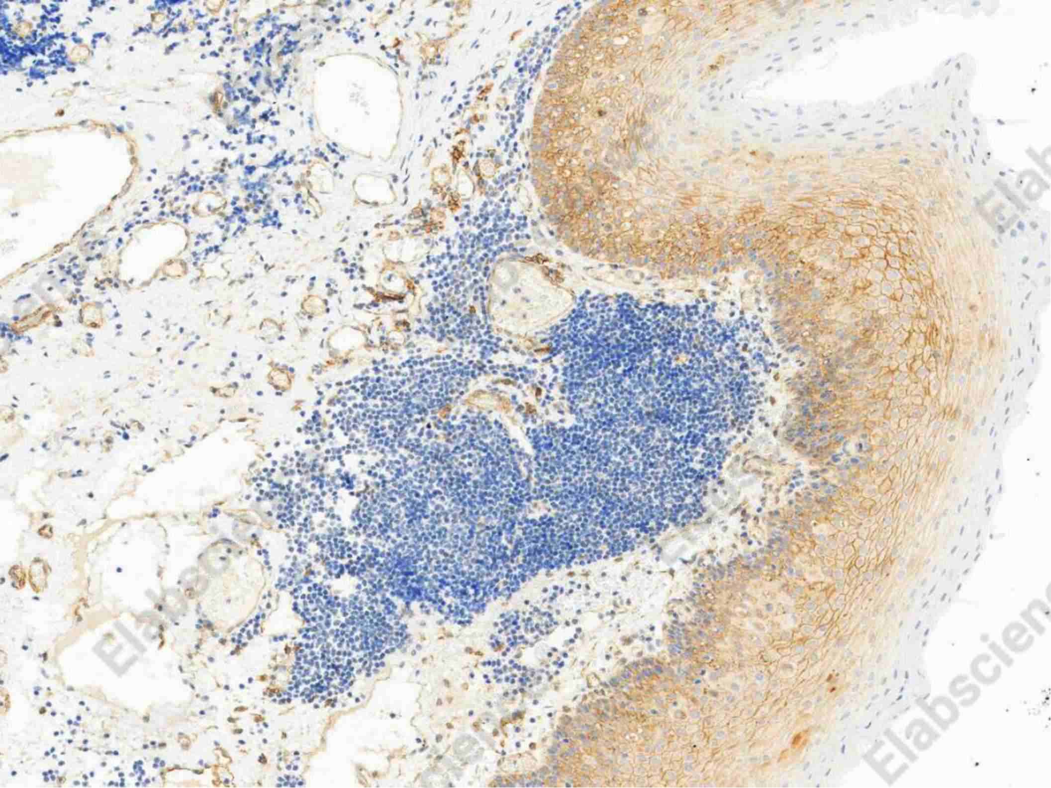 Recombinant Syndecan-1/SDC1 Monoclonal Antibody - 1