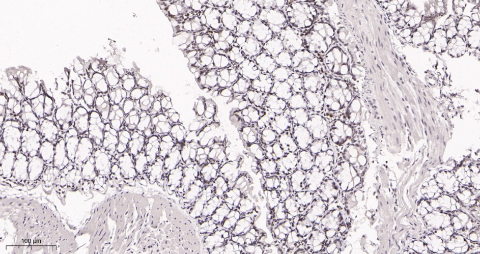 Recombinant SP1 Monoclonal Antibody - small - 3