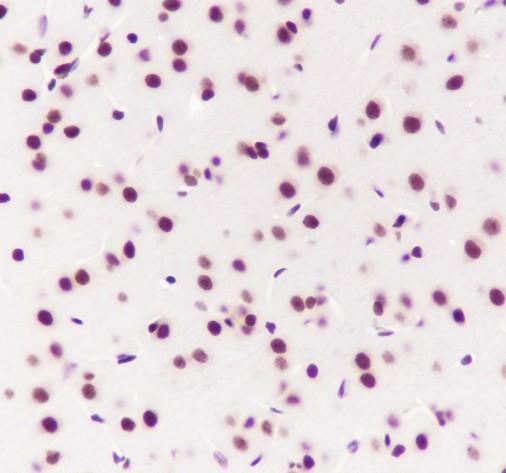 Recombinant SF3B3 Monoclonal Antibody - small - 3
