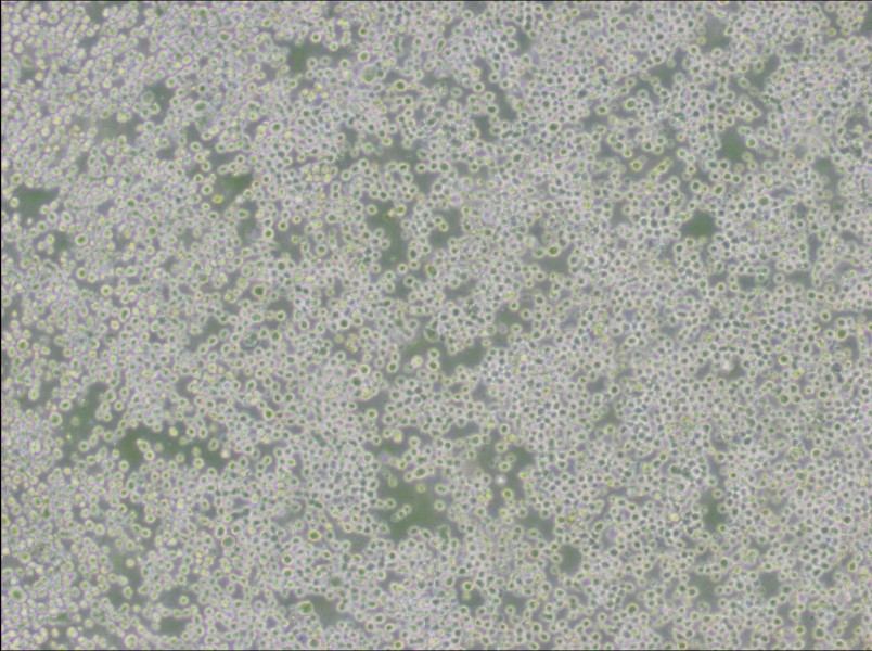 OKT 3 Cell Complete Medium - 2