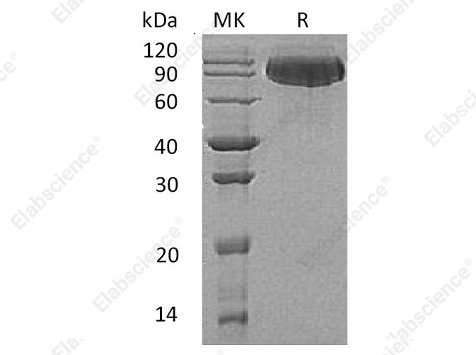 Recombinant Human Butyrylcholinesterase/BCHE Protein (His Tag) - 1