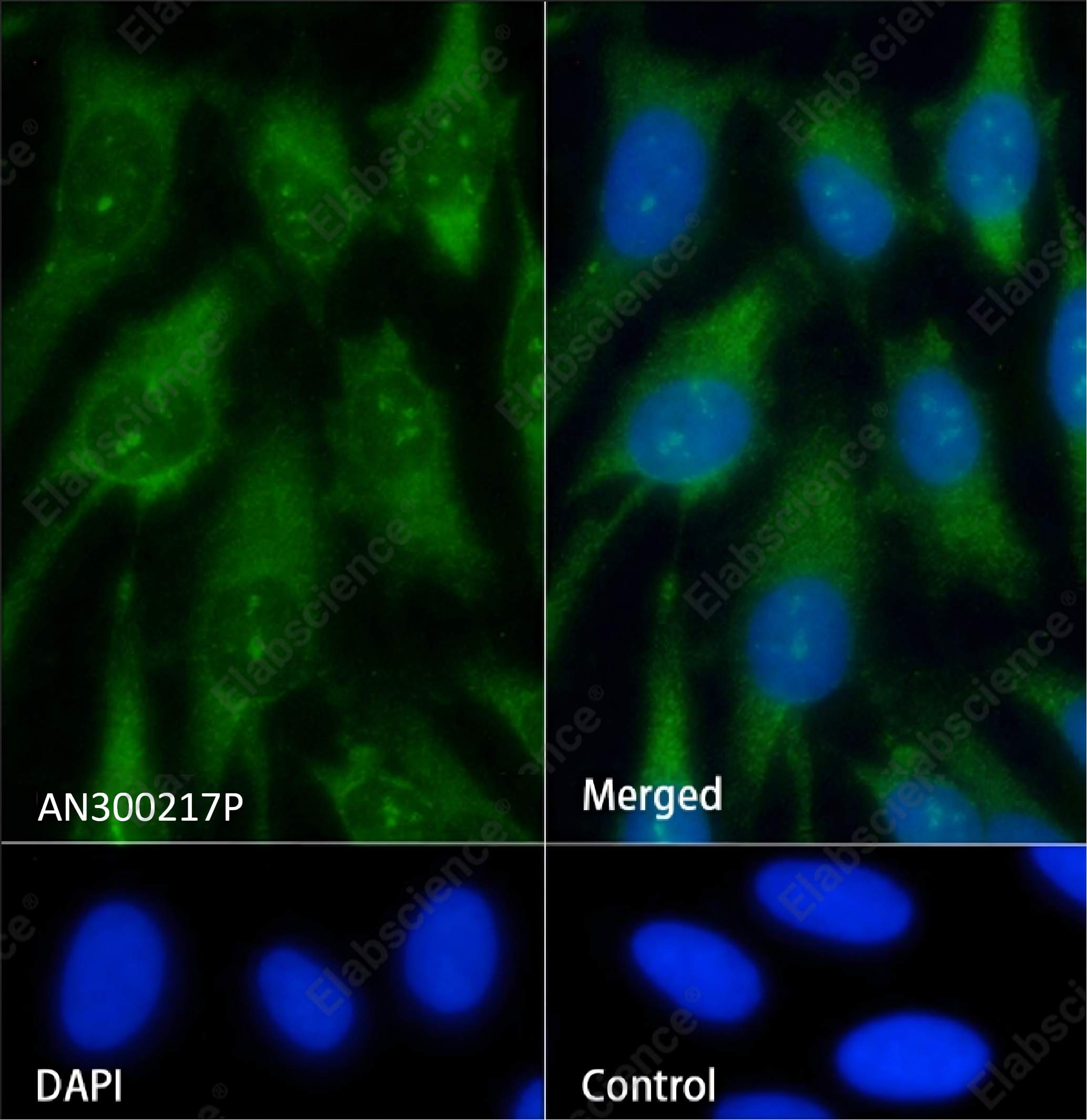 Recombinant NGF/NGFB Monoclonal Antibody - 2