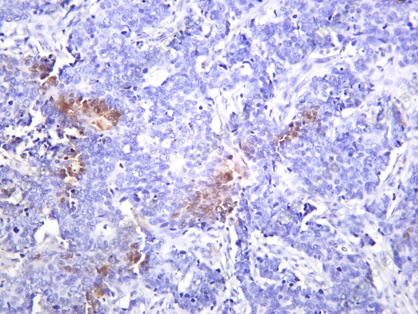 Recombinant JAK2 Monoclonal Antibody - 2