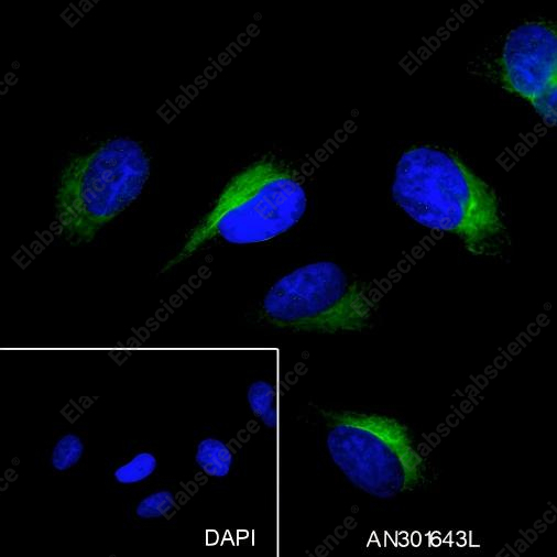 Recombinant Phospho-PTP1B (Ser386) Monoclonal Antibody - 3