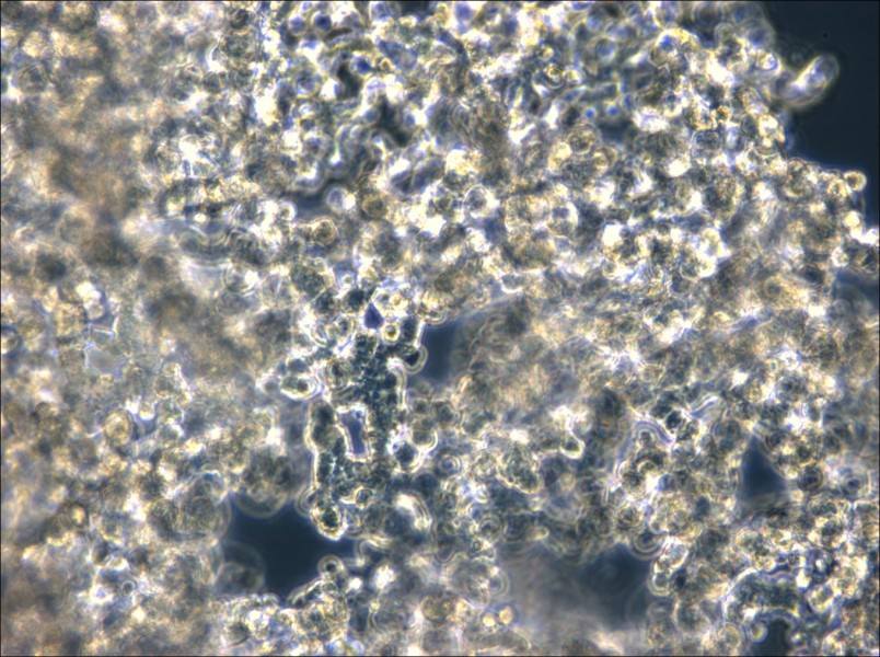 NCI-H526 Cell Complete Medium - small - 6