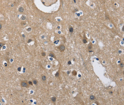 CD160 Polyclonal Antibody - 3