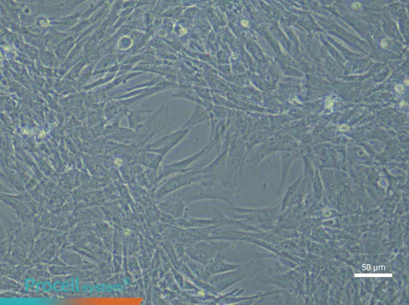 Rat Pulmonary Artery Smooth Muscle (Primary cell immortalization) Cell Complete MediumRat Pulmonary Artery Smooth Muscle (Primary cell immortalization) Cell Complete Medium - 4