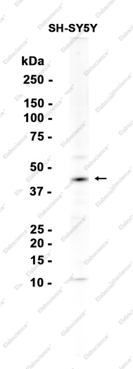 Recombinant Zic1 Monoclonal Antibody - 1