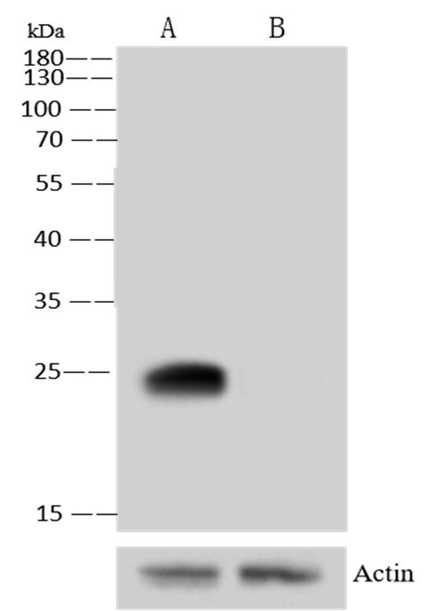 Recombinant SOD2 Monoclonal Antibody - small - 1