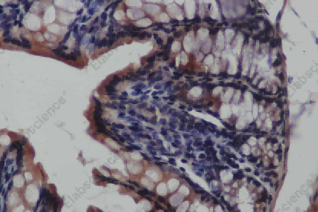 CK-19 Polyclonal Antibody - 2