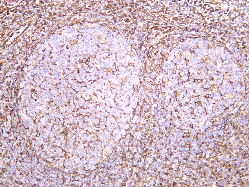 Recombinant TMEM173 Monoclonal Antibody - small - 5