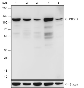 Recombinant PTPN12 Monoclonal Antibody-searchlist-1