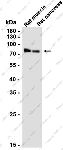 Recombinant PRMT7 Monoclonal Antibody - 2