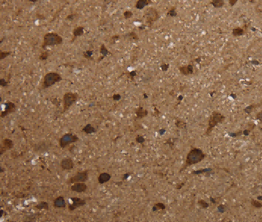 HSD17B13 Polyclonal Antibody - 3