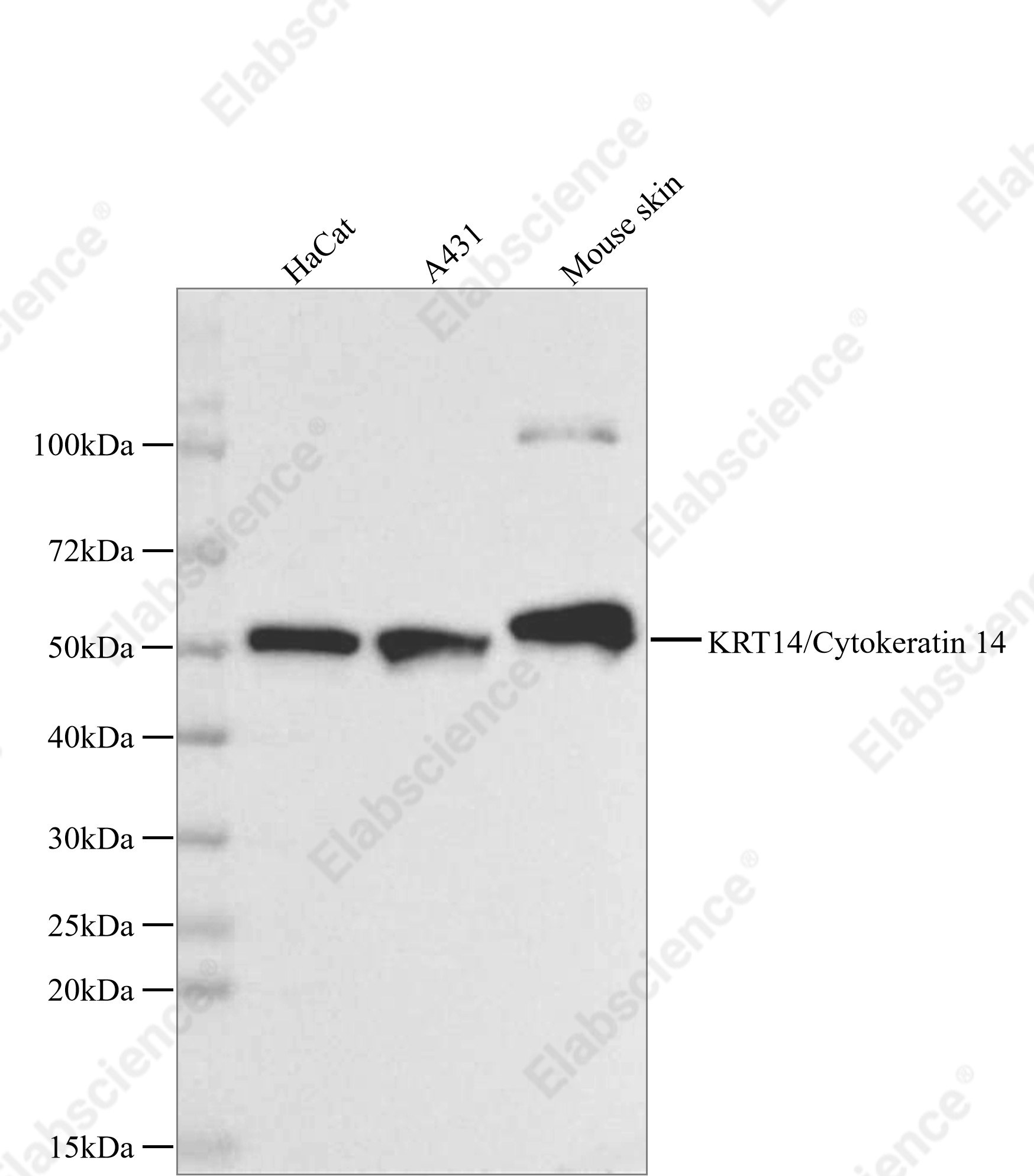 Recombinant KRT14/Cytokeratin 14 Monoclonal Antibody - 1