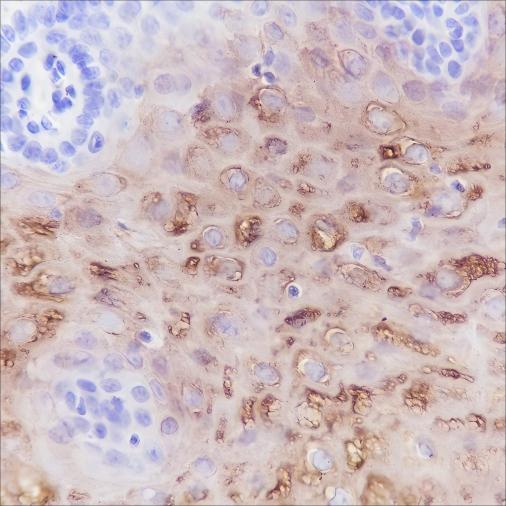 Recombinant Keratin 4 Monoclonal Antibody-searchlist-1