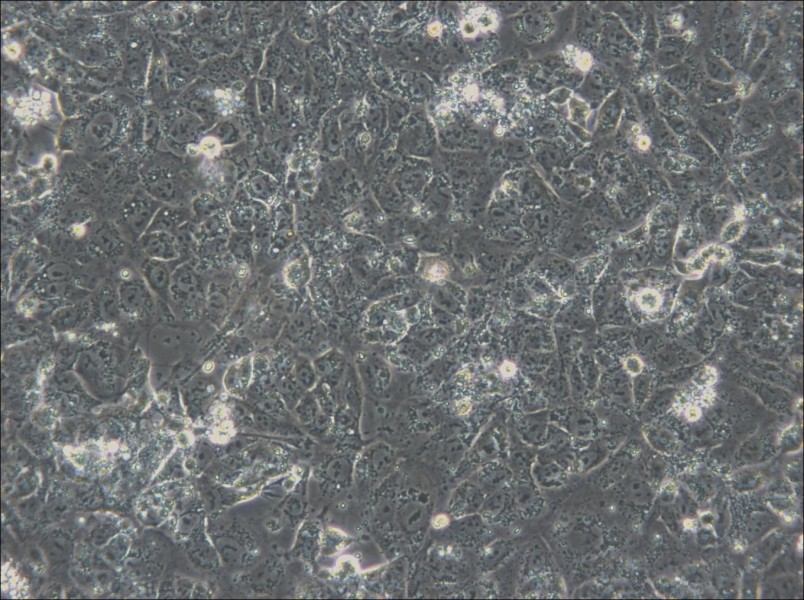 NTERA-2 Cell Complete Medium - small - 6