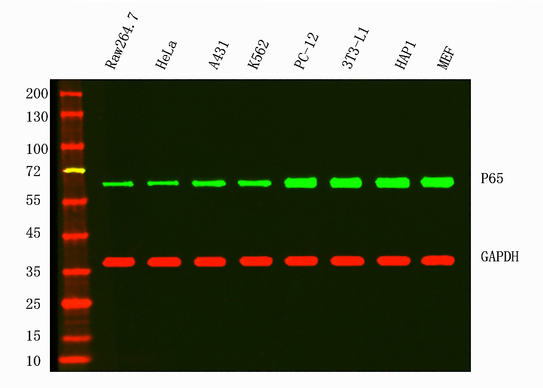 Recombinant NF-κB p65 Monoclonal Antibody - 2