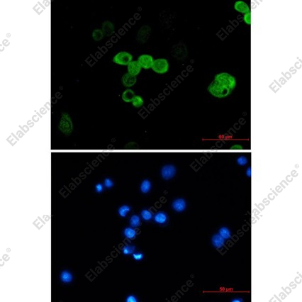 Recombinant CRABP2 Monoclonal Antibody - 2