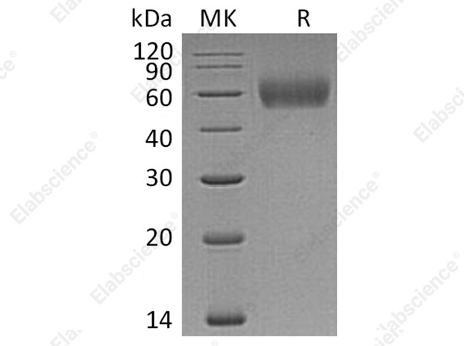 Recombinant Human IL1R2/CD121b Protein (His Tag) - 1