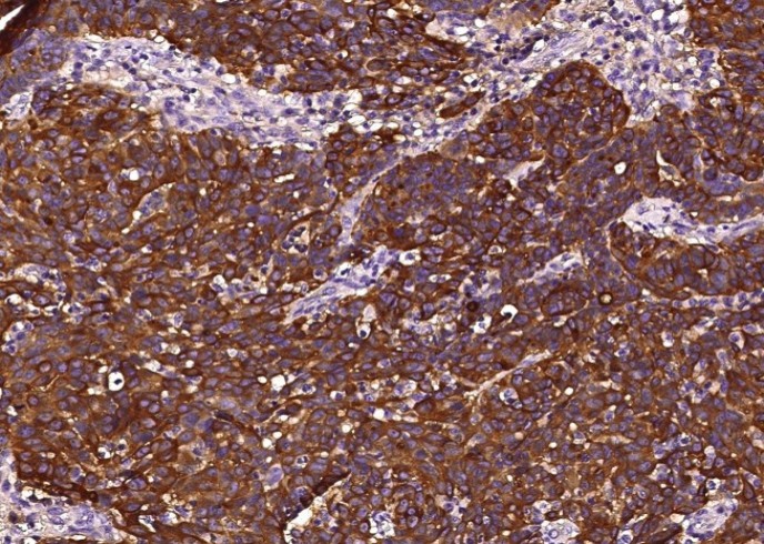 Recombinant Clusterin/Apolipoprotein J/Apo-J/CLU Monoclonal Antibody - small - 2