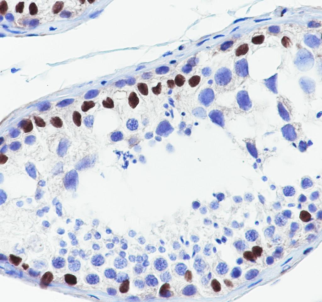 Recombinant WT1 Monoclonal Antibody - small - 4