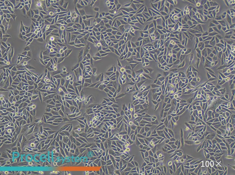 SiHa Cell Complete Medium - 1