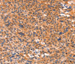 AMPD1 Polyclonal Antibody - 2