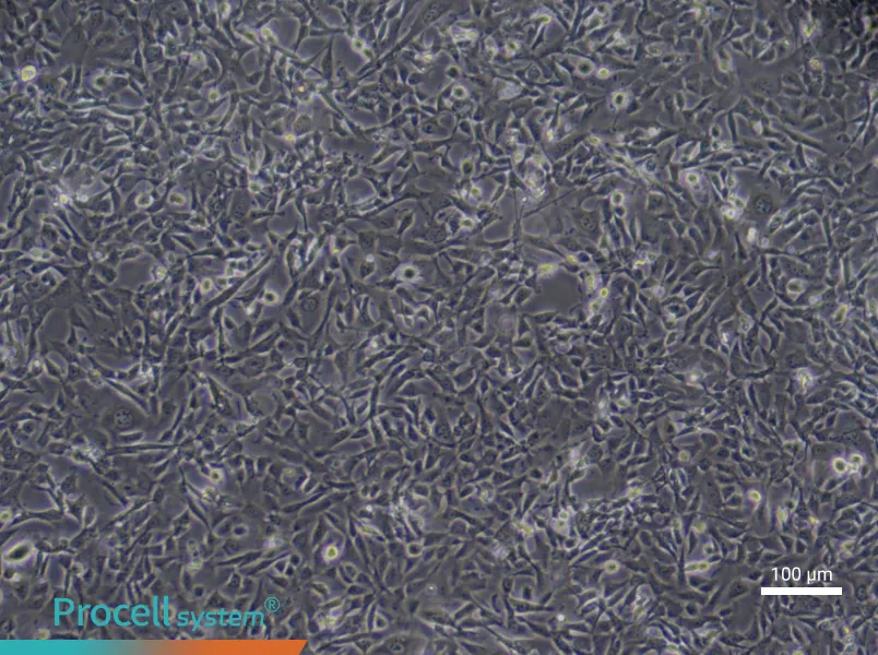 Human Cardiac Microvascular Endothelial (Primary cell immortalization) Cell Complete Medium - 1