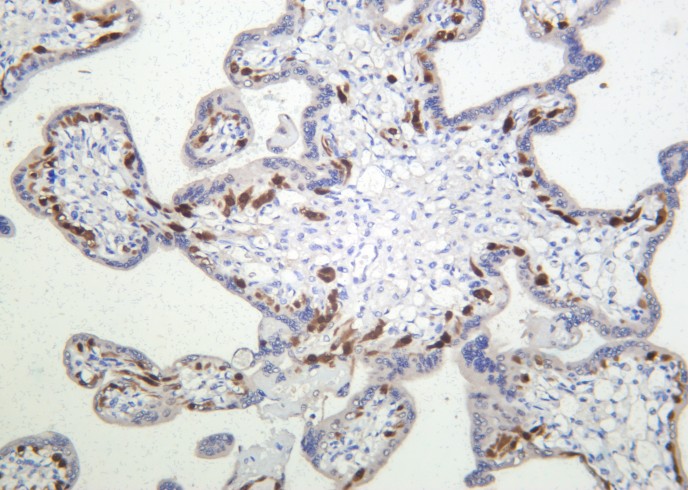 Recombinant FoxO4 Monoclonal Antibody - small - 2