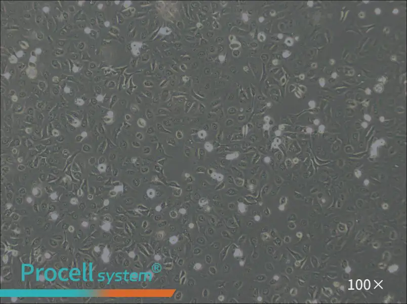 OVCA429 Cell Complete Medium - 1