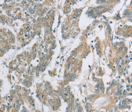 EDA2R Polyclonal Antibody - 3